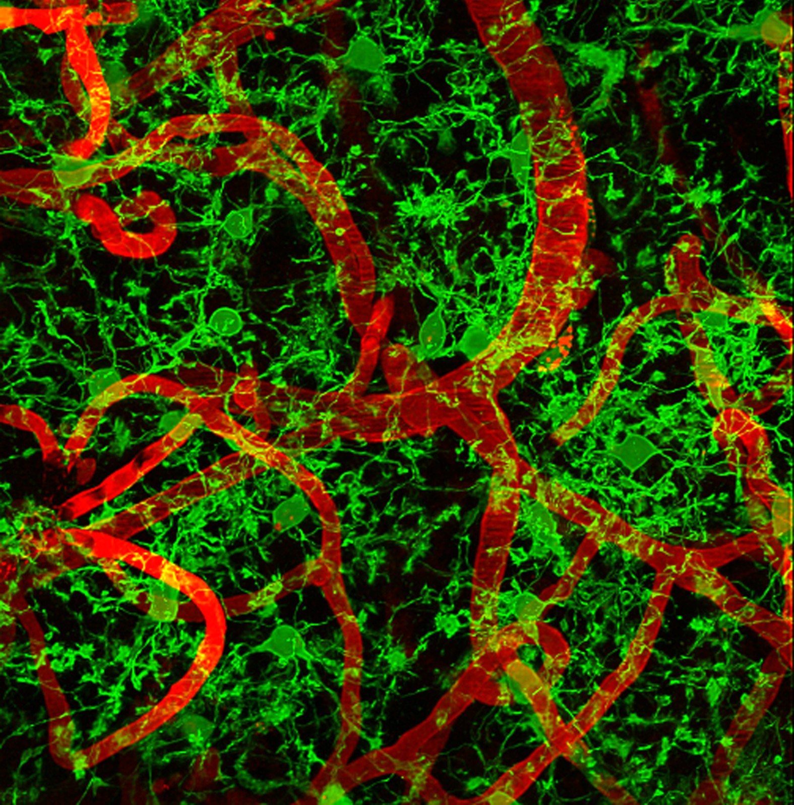 Meet Your Brain’s Secret Defense System: What Microglia Are and Why They Matter